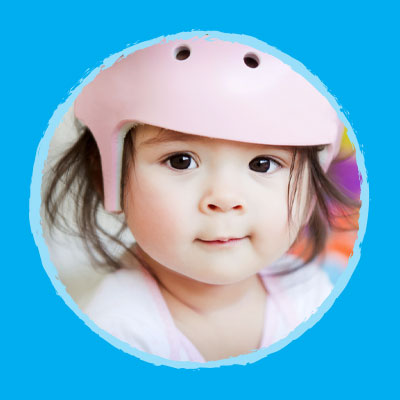 agape who we help 08 torticollis plagiocephaly 01a